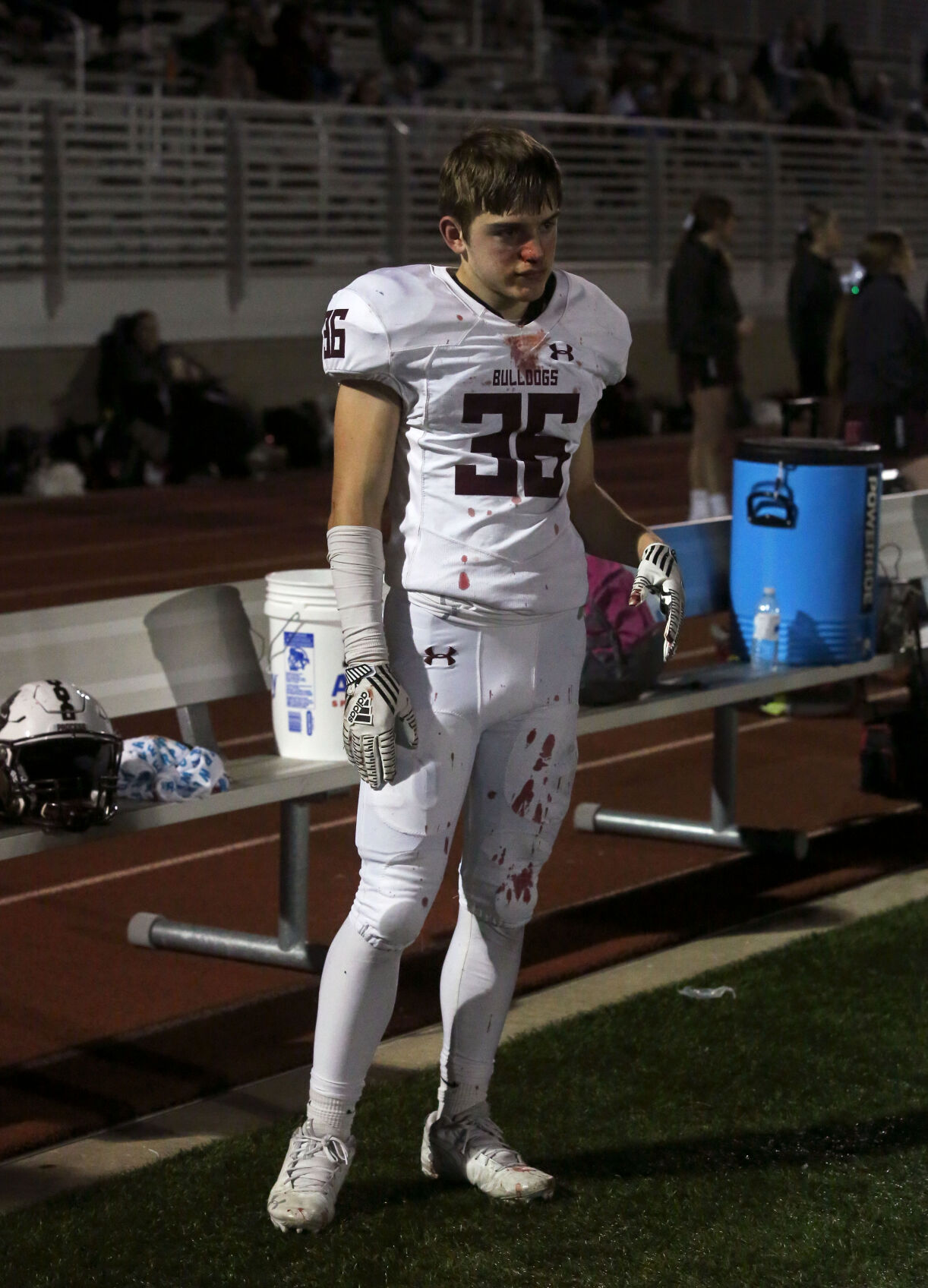 Rolla senior Jackson Herdade stands covered in blood from his nose